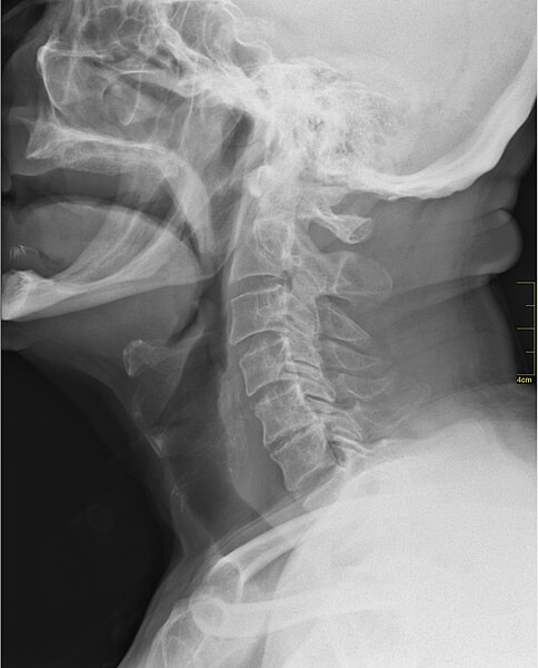 File:Medical X-Ray imaging EJE04 nevit.jpg