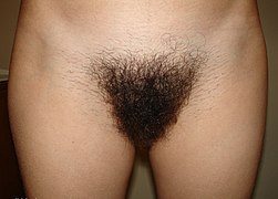 Hairy pubis.jpg