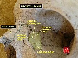 Lacrimal and nasal bones.jpg