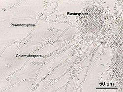 A photomicrograph of Candida albicans showing morphological characteristics