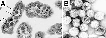 (A) Electron micrograph of Halothiobacillus neapolitanus cells, arrows highlight carboxysomes. (B) Image of intact carboxysomes isolated from H. neapolitanus. Scale bars are 100 nm. Carboxysomes EM.jpg