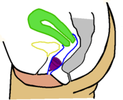 Copa menstrual en la vagina