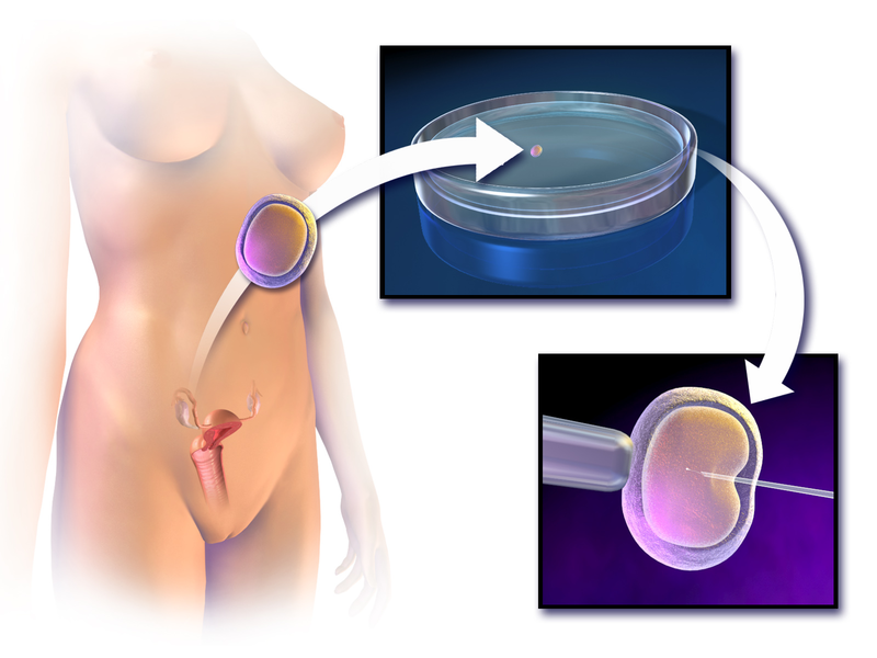 File:Blausen 0583 InVitroFertilization.png