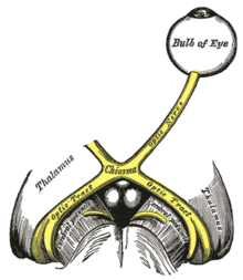 Лівий зоровий нерв і зоровий тракт.