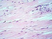 Tecido muscular, núcleos celulares (púrpuras azulados), material extracelular (rosa).