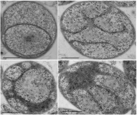 Электронные микрофотографии клеток Gemmata obscuriglobus[англ.]. Видна сложная система внутренних мембран