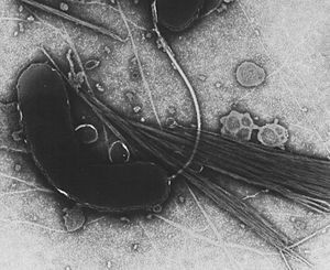 Vibrio cholerae, the bacterium that causes cho...