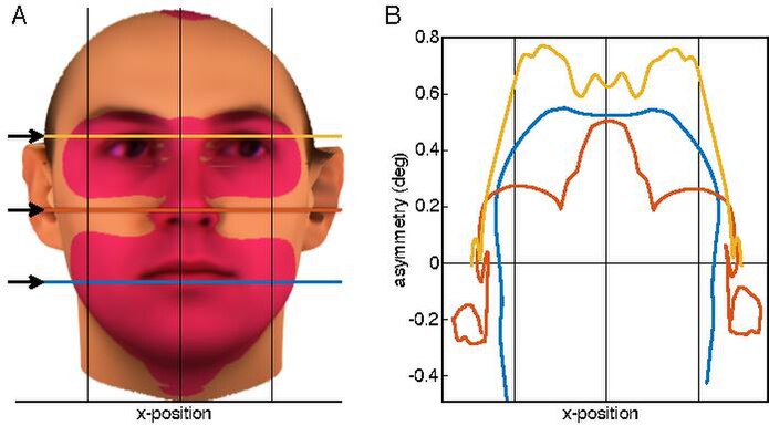 File:Aurofacial asymmetry.pdf