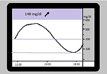 CGM-Display