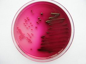 Кишечная палочка (Escherichia coli)