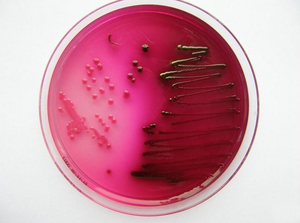 Česky: Escherichia coli na Endově agaru Englis...