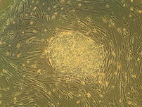 A colony of embryonic stem cells, from the H9 ...