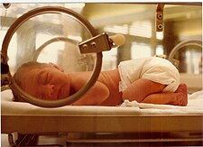 Předčasně narozené dítě v inkubátoru
