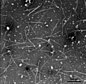 EM-Aufnahme von Virionen des Nar­zis­sen-Mosaik­virus (NMV)