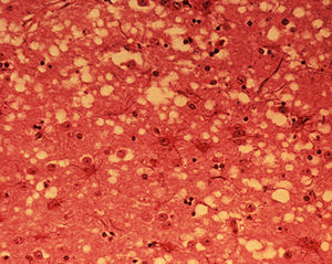 This micrograph of brain tissue reveals the cy...