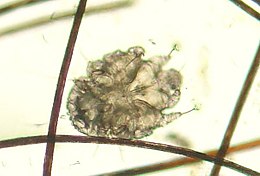 260px Canine scabies mite