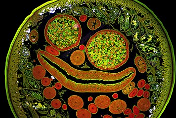 Vue en coupe d'un exemplaire mâle d'Ascaris, un parasite intestinal, photographié avec un appareil Nikon doté de condenseur pour champ sombre (Darkfield oil condenser) 1,40. Le grossissement de l'image est de 200 fois. Gagnant de la catégorie Microscopy images en 2017, par Massimo Brizzi, Italie