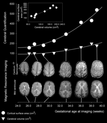 Human cortical development between 26 and 39 week gestational age Human Cortical Development.png