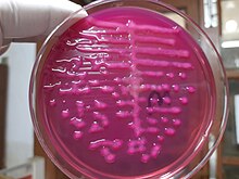 Zdjęcie agaru MacConkeya, który zmienił barwę na różową, co oznacza, że posiana na nim bakteria (Klebsiellla ozaenae) fermentuje laktozę