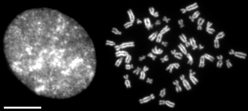 Nucli cel·lular durant la interfase (esquerra) i cromosomes humans condensats durant la mitosi (dreta) (barra blanca = 10 μm)