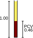 Диаграма на ръчния тест за хематокрит, показващ фракцията на червените кръвни клетки, измерена като 0,46.