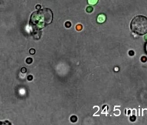 Soubor: S15-Competitive Phagocytosis Assay in Collagen.ogv