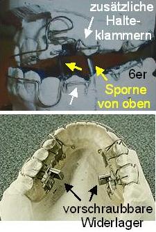 Rückschubdoppelplatte Doppelbild, Details beschriftet