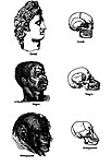 Typische kraniometrische Darstellung des 19. Jahrhunderts, in der eine angebliche Ähnlichkeit von Affen und Schwarzen dargestellt werden soll.