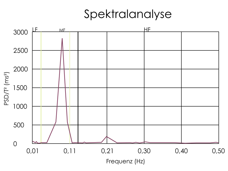 Datei:Spektralanalyse.svg