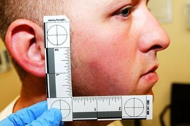 File:Darren wilson bruise.jpg