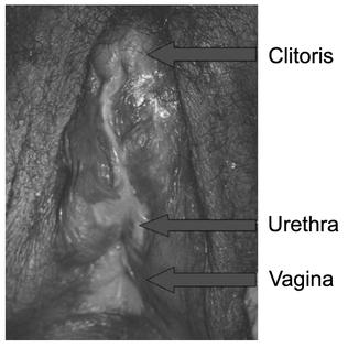 Low levels of testosterone in females