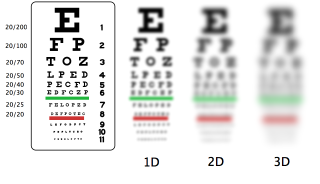 Myopia vision