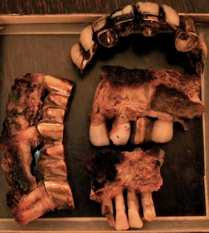 File:Adolf Hitler's dental remains (colour).jpg