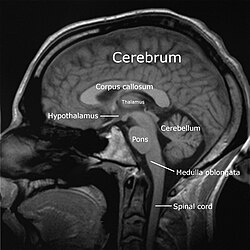 Sagittal slice from a MRI scan of a human brain. See an animated sequence of slices.