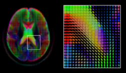 A mid-axial slice of the ICBM diffusion tensor image template. Each voxel's value is a tensor represented here by an ellipsoid. Color denotes principal orientation: red = left-right, blue=inferior-superior, green = posterior-anterior DiffusionMRI glyphs.png