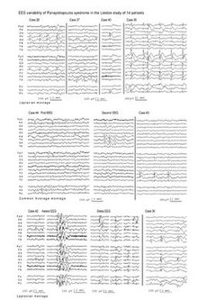 Symptomatic Epilepsy Wiki