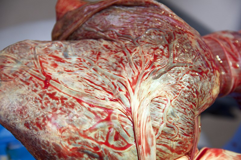 File:Fetal side close-up of freshly delivered placenta.jpeg