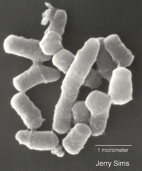 File:Rhodococcus sp..jpg