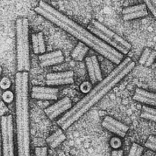 Электронный микроскоп вируса табачных погремушек.jpg