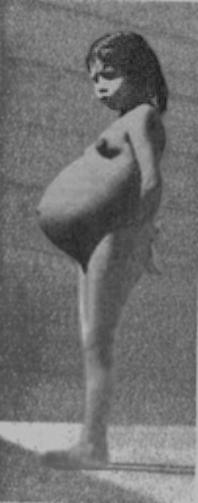 پرونده:Lina Medina.jpg