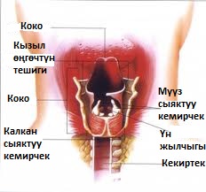 Файл:Ларингит.jpg