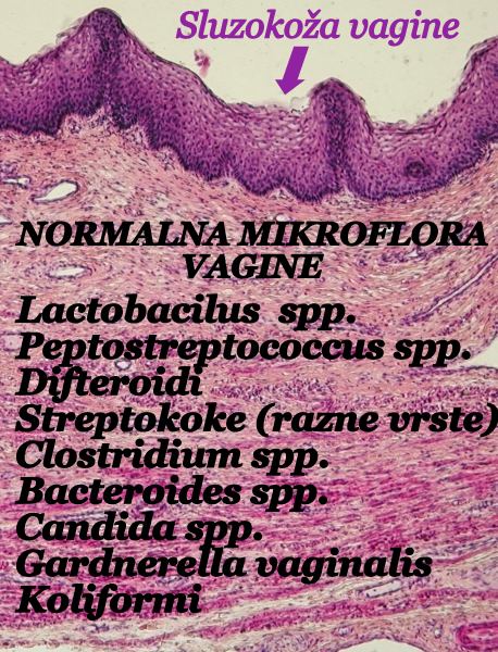 Датотека:Normalna mikroflora vagine.jpg