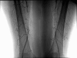 Датотека:Angiografija 3.JPG