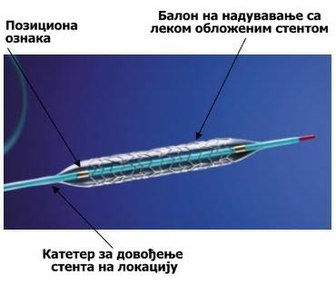 Леком обложен стент