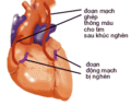 Hình xem trước của phiên bản lúc 11:10, ngày 27 tháng 4 năm 2006