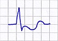 Vorschaubild der Version vom 21:42, 17. Feb. 2006