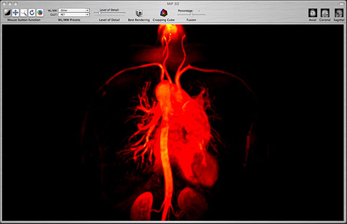 ファイル:OsiriX 17.1.jpg