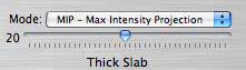 ThickSlab設定