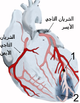 نوبة قلبية