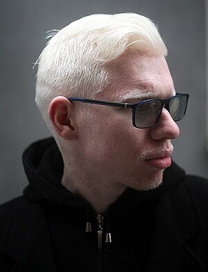 Reper Albino